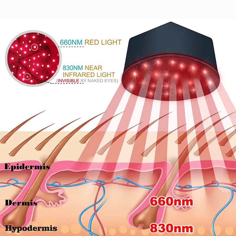 Casque de Thérapie par Lumière Rouge – LED Infrarouge pour la Croissance des Cheveux